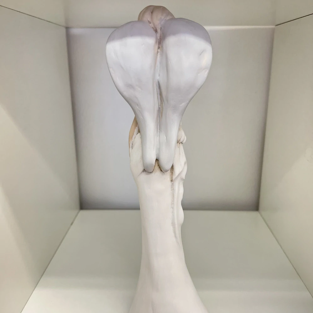 DEKORACE ANDĚL ZDOBENÉ ŠATY